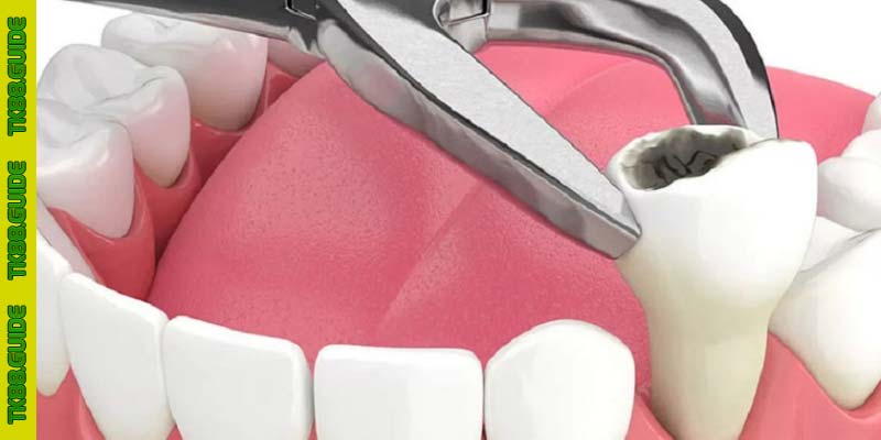 Giải Mã Giấc Mơ Thấy Bị Nhổ Răng: Điềm Báo Hay Lời Gợi Ý Số Đề? 2 Giải Mã Giấc Mơ Thấy Bị Nhổ Răng